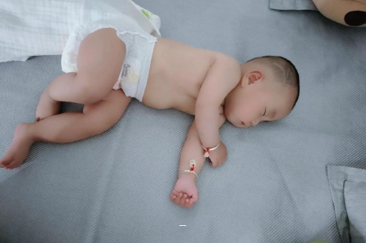 保亭宝宝脸上有白色斑块